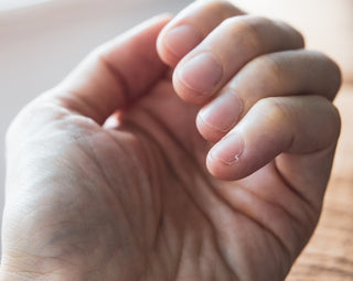 Hangnails: Causes, Treatment, Risks, and More
